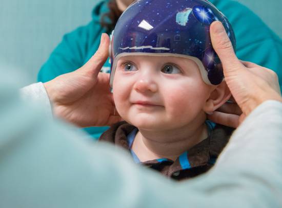 Orion Gillette plagiocephaly patient during craniocap fitting