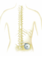 Rehabilitation After Intrathecal Baclofen Pump Placement 