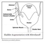 mitrofanoff.jpg