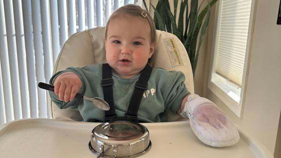 Gillette Children's patient in high-chair receiving CIMT therapy.