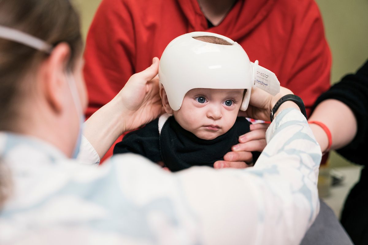 A baby getting a CranioCap adjustment in the Gillette clinic